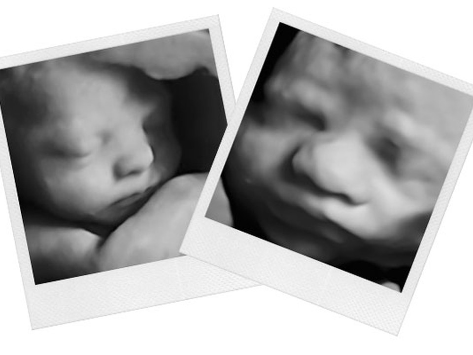 Example 3D keepsake ultrasound image of a baby